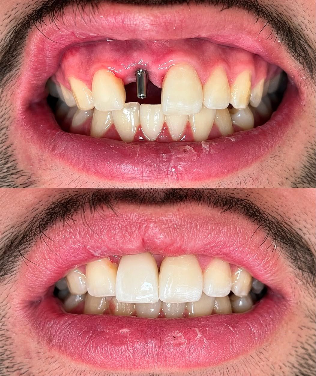 Antes e Depois - Odonto Help